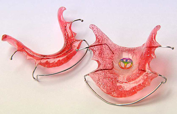 Understanding Retainers Understanding Retainers