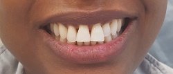 Arlington Dental MA Arlington Dental MA